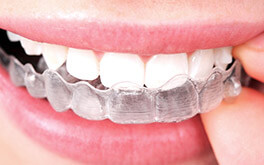 Clear Invisalign aligner tray